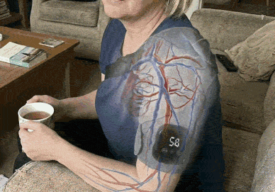 Animation of blood flow returning to the shoulder joint